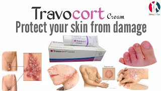 Travocort cream benefits and full review in UrduHindi [upl. by Nappie]