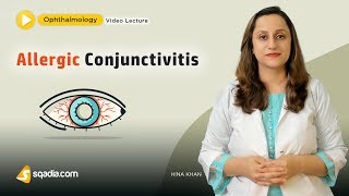 Allergic Conjunctivitis  Ophthalmology Student Lecture  VLearning  sqadiacom [upl. by Coralyn]