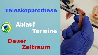 Die Teleskopprothese  Ablauf Termine Dauer und Zeitraum [upl. by Ruford]