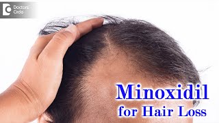 Right way to use MINOXIDIL SOLUTION for HAIR LOSSEXPERT ADVICEDrDeepak P Devakar Doctors Circle [upl. by Aniral]