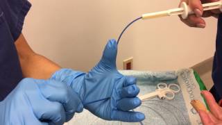 Colon Polyp Removal  Colonoscopy [upl. by Sachi]