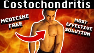 Costochondritis and Bodybuilding  My 7 year experience of handling this chest injury [upl. by Edgar]