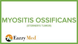 MYOSITIS OSSIFICANS STERNERS TUMOR [upl. by Ened]