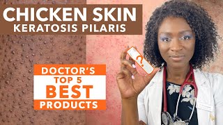 Keratosis Pilaris Chicken Skin  Treating Dry Bumpy Skin  Special Tips for Black Skin  Ask Doctor [upl. by Annovahs]