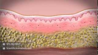 What is stem cell therapy [upl. by Nerhe653]