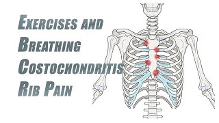 Exercises and Breathing Tips for Rib Pain  Costochondritis [upl. by Shum]