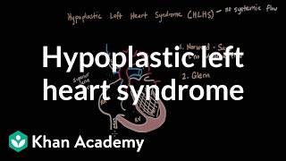 Hypoplastic left heart syndrome and norwood glenn fontan  NCLEXRN  Khan Academy [upl. by Llenoj]