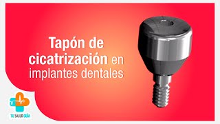 Tapón de cicatrización en implantes dentales  Tu Salud Guía [upl. by Venu107]