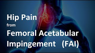 Hip Pain from Femoral Acetabular Impingement FAI  What is it and how to treat it [upl. by Waligore]