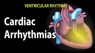 Cardiac Arrhythmias Animation [upl. by Neelrad622]