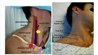 Jugular venous pulse anatomical aspects [upl. by Oremoh]