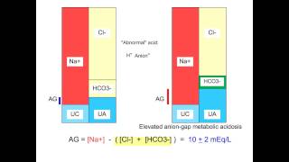 Metabolic Acidosis  Anion Gap  M Lam [upl. by Lockhart911]