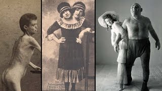 The Dark History of FREAK SHOWS [upl. by Lak970]