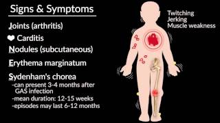 Acute Rheumatic Fever by E Rusingiza  OPENPediatrics [upl. by Jacquet882]