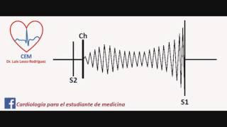 Soplo de la estenosis mitral [upl. by Artemahs]