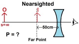 Physics  Optics Vision Correction 2 of 5 Nearsighted [upl. by Valerie]