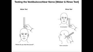 Interpreting the WeberRinne Tests EXPLAINED [upl. by Cleon186]