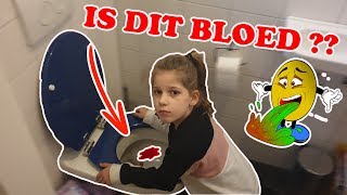 quotMAMA IK HEB BLOED GESPUUGDquot KOETLIFE VLOG [upl. by Keeler105]