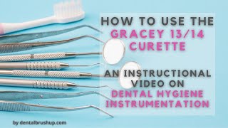 How to use the Gracey 1314 Curette [upl. by Hassin989]