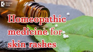 Homeopathic medicine for skin rashes  Dr Surekha Tiwari [upl. by Yorker]