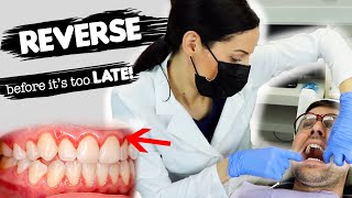 How To Treat Gum Disease [upl. by Garner]