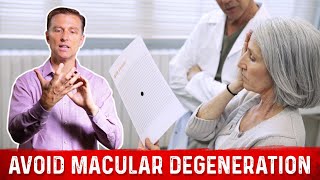 How to Prevent Macular Degeneration – Dr Berg [upl. by Harriman]