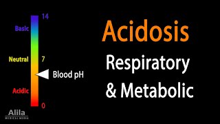 Acidosis Respiratory and Metabolic Animation [upl. by Zumwalt]