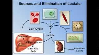 Elevated Anion Gap Metabolic Acidosis ABG Interpretation  Lesson 8 [upl. by Tabib]