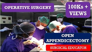 OPEN APPENDECTOMY STEP BY STEP OPERATIVE SURGERY [upl. by Gabby]