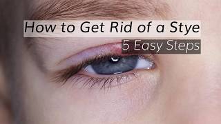 Eye Stye Treatment How to Get Rid of A Stye in 5 Steps [upl. by Paley]