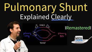 Shunting Explained Clearly Pulmonary Shunt  Remastered [upl. by Vaientina153]