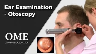 Otoscopy Ear Examination  ENT [upl. by Lednahs]