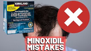 5 BIGGEST MISTAKES When Using Minoxidil REVEALED [upl. by Mavra]