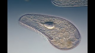 Microbiology of Eukaryotes Protozoa [upl. by Amadis535]