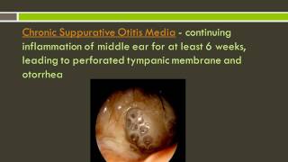 Otitis Externa and Otitis Media [upl. by Ambros249]