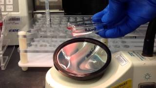 Blood Bank Antibody Screen Tube Method [upl. by Htebharas]