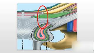 Inguinal Hernias Explained [upl. by Nitsid]