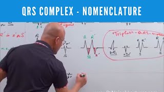 ECG  QRS Complex in EKG  Nomenclature  Electrocardiography🫀 [upl. by Morganstein600]