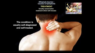 Whiplash Injuries Causes amp Symptoms  Everything You Need To Know  Dr Nabil Ebraheim [upl. by Silvie]