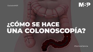 ¿Cómo se hace una colonoscopía ExclusivoMSP [upl. by Sung]