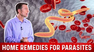 Best Home Remedies for Parasites – Dr Berg [upl. by Enitselec]