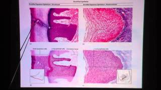 Keratinized Stratified Squamous Epithelium [upl. by Ardnoek392]