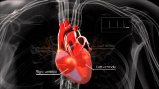 Cardioversion of Atrial Flutter [upl. by Essy534]