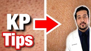 Keratosis Pilaris How to treat dry bumpy skin aka chicken skin  Dr Shereene Idriss [upl. by Acimak]