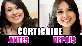 CORTICÓIDE  EFEITOS COLATERAIS  ANTES E DEPOIS DO MEU TRATAMENTO [upl. by Dillie985]