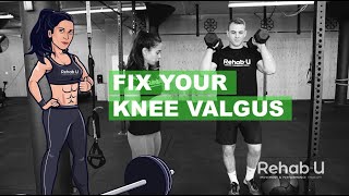 The Real Fix For Knee Valgus [upl. by Loree419]