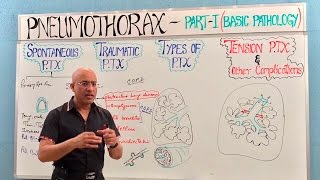 Pneumothorax  Spontaneous Tension amp Traumatic🫁 [upl. by Ordnagela413]