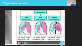 Open Pneumothorax  Australian Paramedical College [upl. by Siradal]