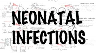 Neonatal Infections  Overview [upl. by Eirok977]