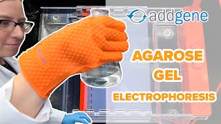 Agarose Gel Electrophoresis [upl. by Alarick]